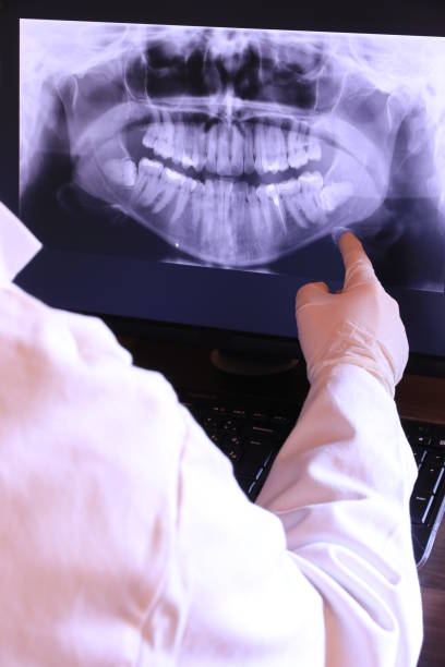 Best Emergency Dentist for Knocked-Out Tooth in Brookfield, MO