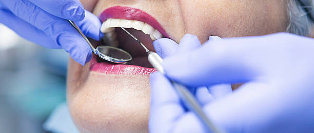 Best Emergency Dental Extractions in Brookfield, MO